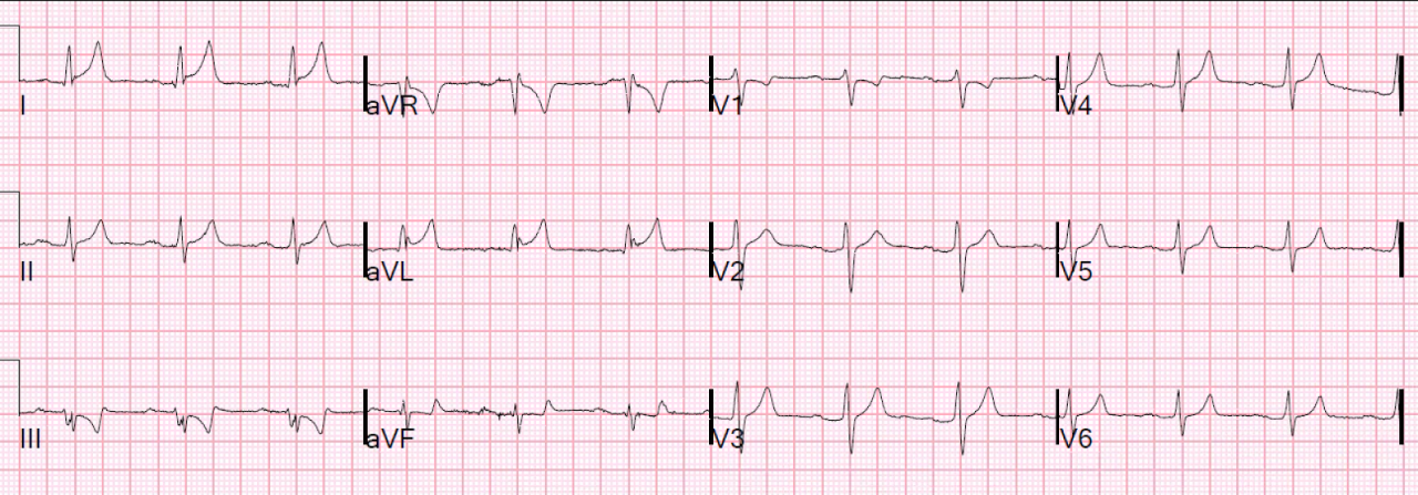 Royals lead the nation in sending good luck messages to the Lionesses ...